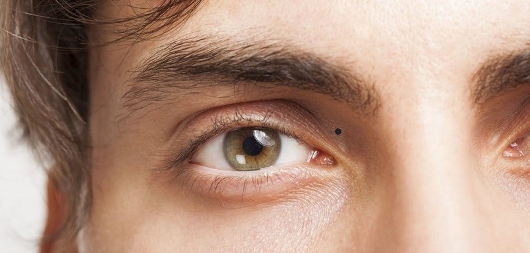 Nốt ruồi ở gần khóe mắt trái là nốt ruồi xấu trên mặt đàn ông, gia chủ khó có tài lộc - ảnh 14